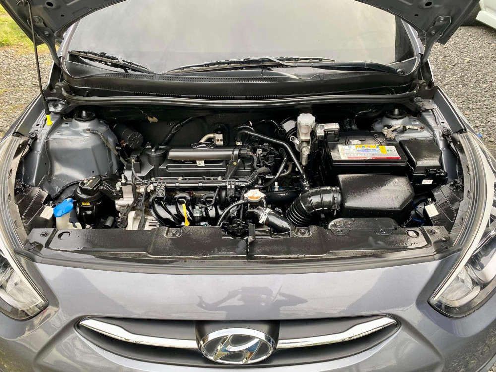 2017 Hyundai Accent 2017 Hyundai Accent